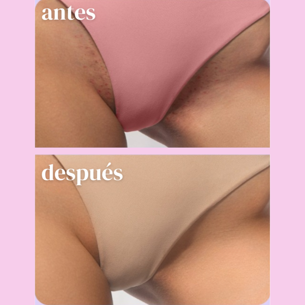 Elira™ - Pack Adiós Bellos Encarnados