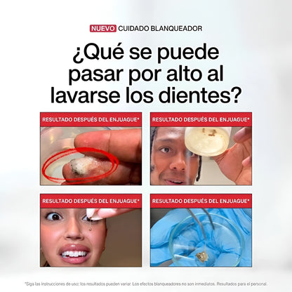 Enjuague Bucal Blanqueador