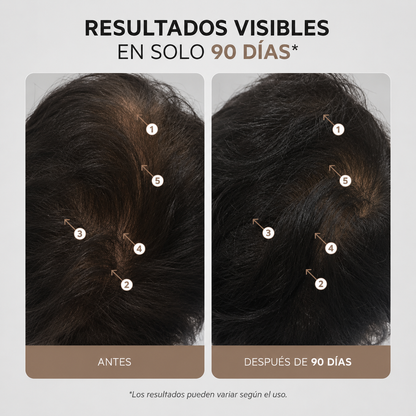 Serum Capilar con Nanoxidil