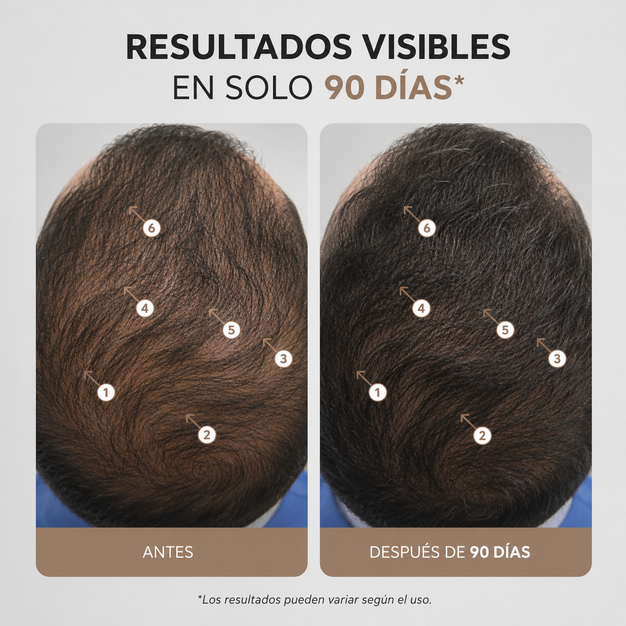 Serum Capilar con Nanoxidil