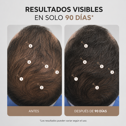 Serum Capilar con Nanoxidil